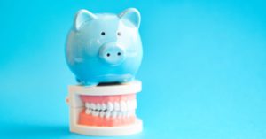 cost-of-the-dentist-in-nz